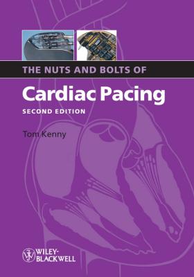 The Nuts and Bolts of Cardiac Pacing - Tom  Kenny