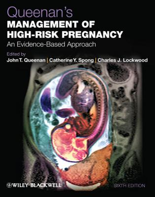 Queenan's Management of High-Risk Pregnancy. An Evidence-Based Approach - Catherine Spong Y.