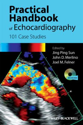 Practical Handbook of Echocardiography. 101 Case Studies - Joel  Felner