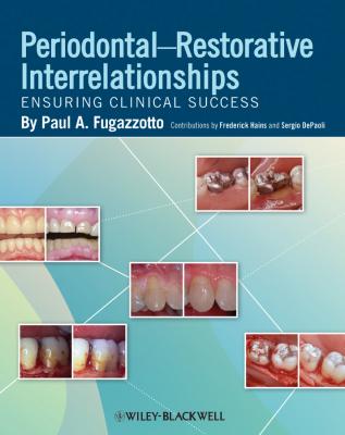 Periodontal-Restorative Interrelationships. Ensuring Clinical Success - Frederick Hains