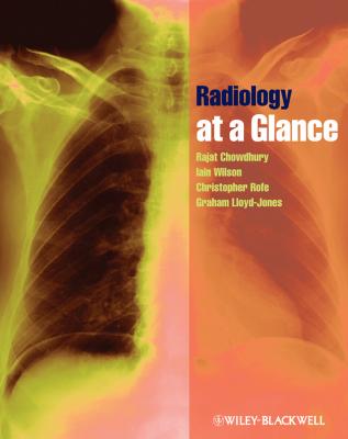 Radiology at a Glance - Iain  Wilson