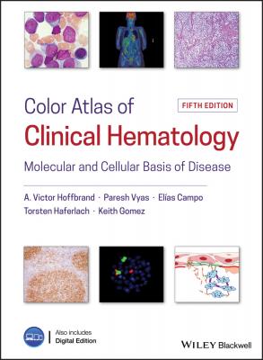 Color Atlas of Clinical Hematology. Molecular and Cellular Basis of Disease - Elias  Campo