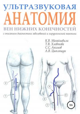 Ультразвуковая анатомия вен нижних конечностей - Константин Витальевич Мазайшвили