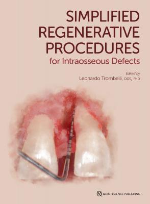 Simplified Regenerative Procedures for Intraosseous Defects - Leonardo Trombelli