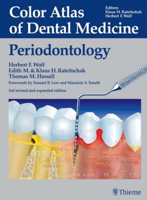 Color Atlas of Dental Medicine: Periodontology - Herbert F. Wolf