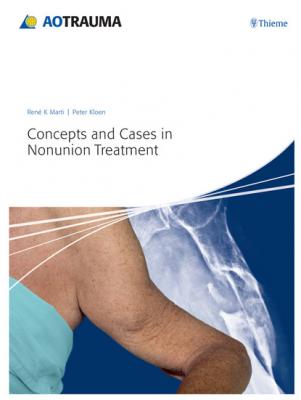 Concepts and Cases in Nonunion Treatment - Ren K. Marti