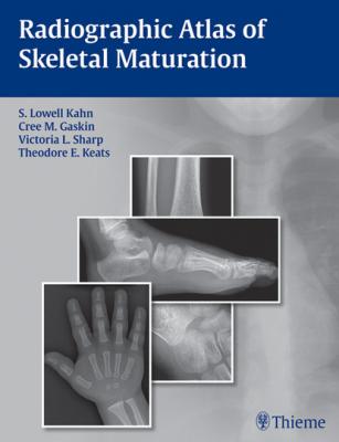Radiographic Atlas of Skeletal Maturation - S. Lowell Kahn
