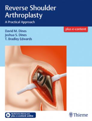 Reverse Shoulder Arthroplasty - David M. Dines