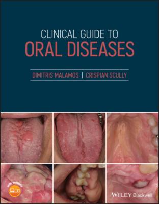 Clinical Guide to Oral Diseases - Crispian Scully