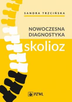 Читать Nowoczesna diagnostyka skolioz - Sandra Trzcińska