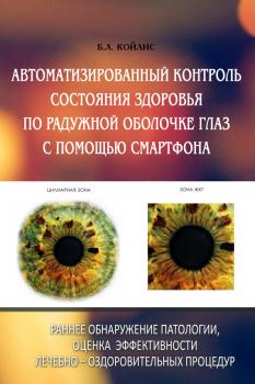 Читать Автоматизированный контроль состояния здоровья по радужной оболочке глаз с помощью смартфона - Б. Л. Койлис