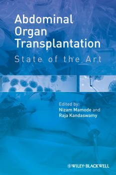 Читать Abdominal Organ Transplantation. State of the Art - Mamode Nizam