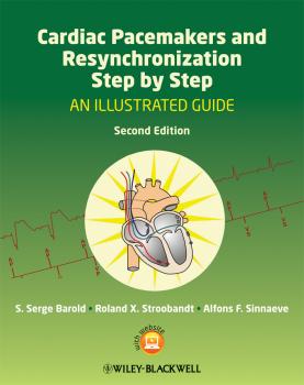 Читать Cardiac Pacemakers and Resynchronization Step by Step. An Illustrated Guide - Roland Stroobandt X.