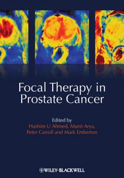Читать Focal Therapy in Prostate Cancer - Manit  Arya