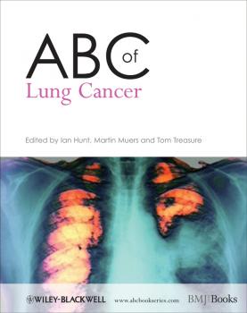 Читать ABC of Lung Cancer - Ian  Hunt