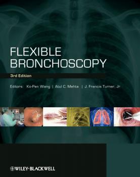 Читать Flexible Bronchoscopy - Ko-Pen  Wang