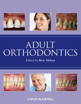 Читать Adult Orthodontics - Birte  Melsen