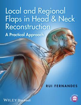 Читать Local and Regional Flaps in Head and Neck Reconstruction. A Practical Approach - Rui  Fernandes