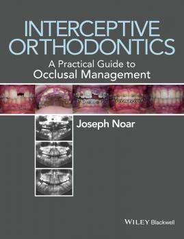 Читать Interceptive Orthodontics. A Practical Guide to Occlusal Management - Joseph  Noar