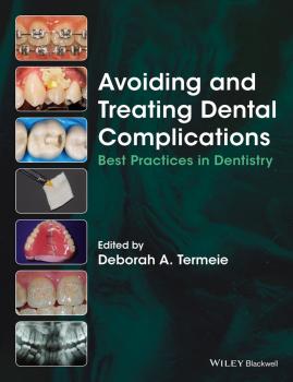 Читать Avoiding and Treating Dental Complications. Best Practices in Dentistry - Deborah Termeie A.