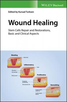Читать Wound Healing. Stem Cells Repair and Restorations, Basic and Clinical Aspects - Kursad  Turksen