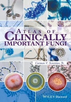 Читать Atlas of Clinically Important Fungi - Carmen V. Sciortino, Jr.
