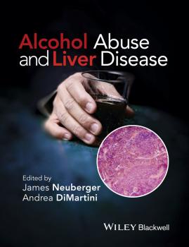 Читать Alcohol Abuse and Liver Disease - James  Neuberger