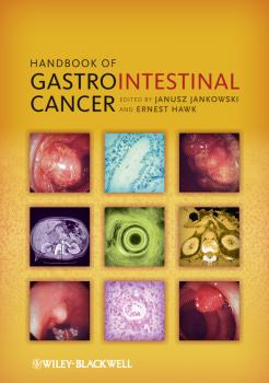 Читать Handbook of Gastrointestinal Cancer - Janusz  Jankowski
