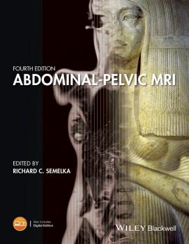 Читать Abdominal-Pelvic MRI - Ersan  Altun