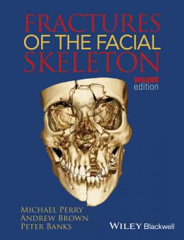 Читать Fractures of the Facial Skeleton - Andrew  Brown