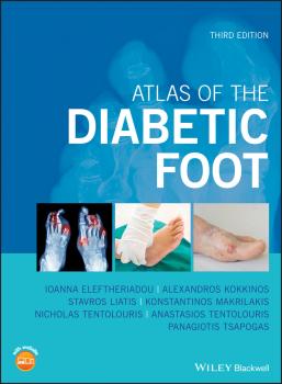 Читать Atlas of the Diabetic Foot - Panagiotis  Tsapogas