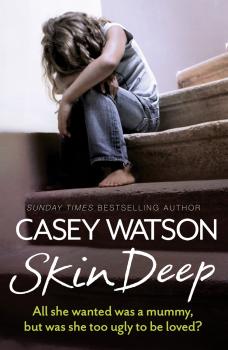 Читать Skin Deep: All She Wanted Was a Mummy, But Was She Too Ugly to Be Loved? - Casey  Watson