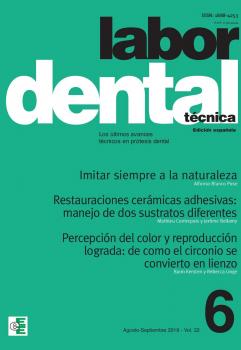 Читать Labor Dental TÃ©cnica Vol.22 Ago-Sep 2019 nÂº6 - Varios autores