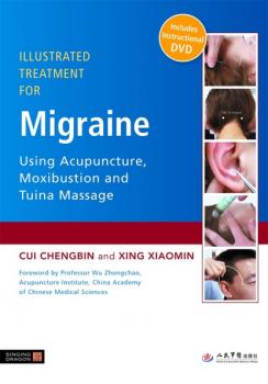 Читать Illustrated Treatment for Migraine Using Acupuncture, Moxibustion and Tuina Massage - Cui Chengbin