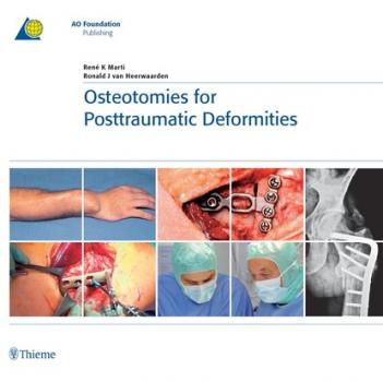 Читать Osteotomies for Posttraumatic Deformities - Ren K. Marti