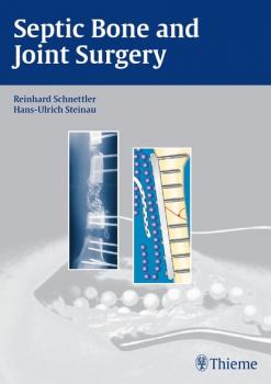 Читать Septic Bone and Joint Surgery - Reinhard Schnettler