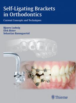 Читать Self-ligating Brackets in Orthodontics - Bjoern Ludwig