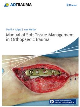 Читать Manual of Soft-tissue Management in Orthopaedic Trauma - David A. Volgas