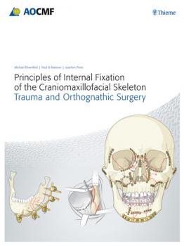 Читать Principles of Internal Fixation of the Craniomaxillofacial Skeleton - Michael Ehrenfeld