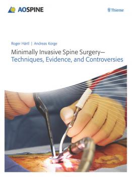 Читать Minimally Invasive Spine Surgery - Roger Haertl