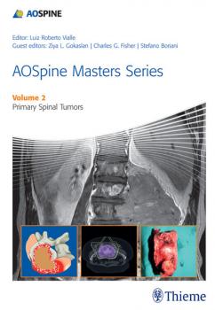 Читать AOSpine Masters Series Volume 2: Primary Spinal Tumors - Luiz Roberto Gomes Vialle
