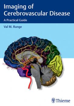 Читать Imaging of Cerebrovascular Disease - Val M. Runge