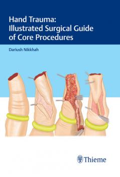 Читать Hand Trauma: Illustrated Surgical Guide of Core Procedures - Dariush Nikkhah