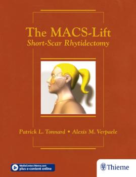 Читать The MACS-Lift - Patrick L. Tonnard