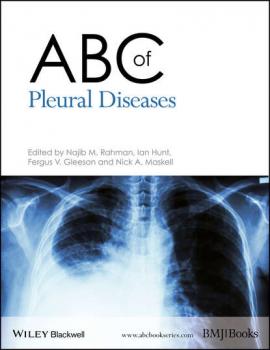 Читать ABC of Pleural Diseases - Ian  Hunt