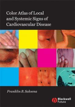 Читать Color Atlas of Local and Systemic Manifestations of Cardiovascular Disease - Группа авторов