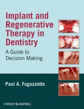 Читать Implant and Regenerative Therapy in Dentistry - Группа авторов