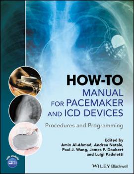Читать How-to Manual for Pacemaker and ICD Devices - Andrea  Natale