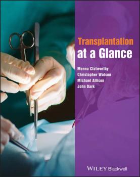 Читать Transplantation at a Glance - Michael  Allison