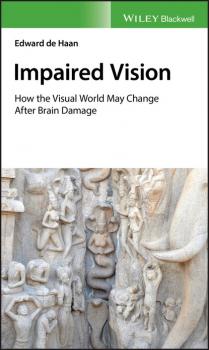 Читать Impaired Vision - Edward de Haan